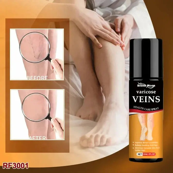 Varicose Vein Relief Spray