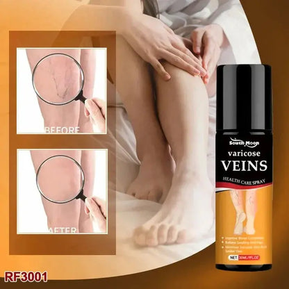 Varicose Vein Relief Spray