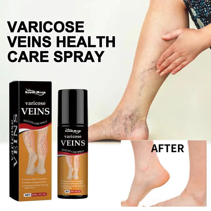 Varicose Vein Relief Spray