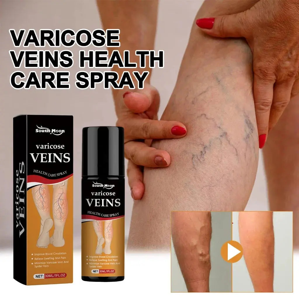Varicose Vein Relief Spray