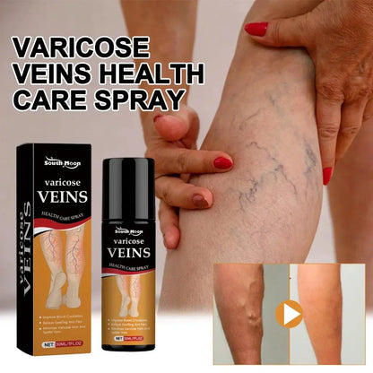 Varicose Vein Relief Spray