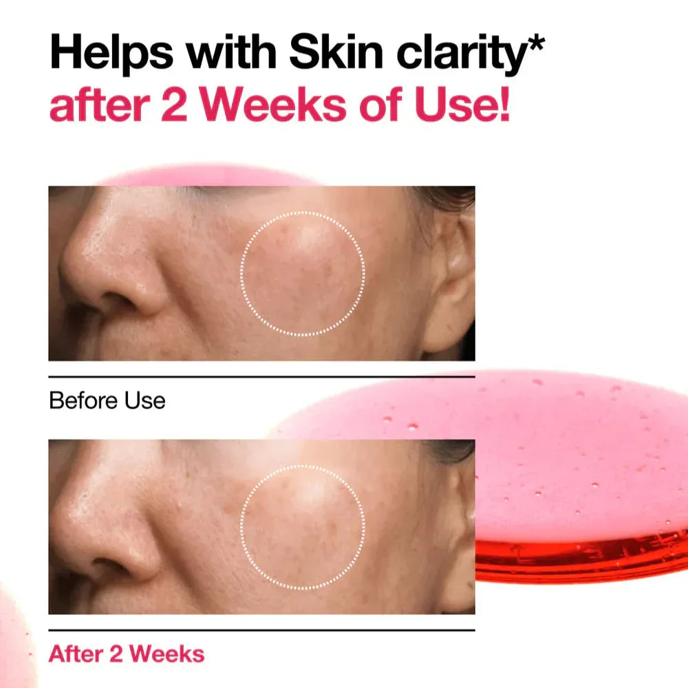 Anua Niacinamide 10%+TXA 4% Dark Spot Correcting Serum