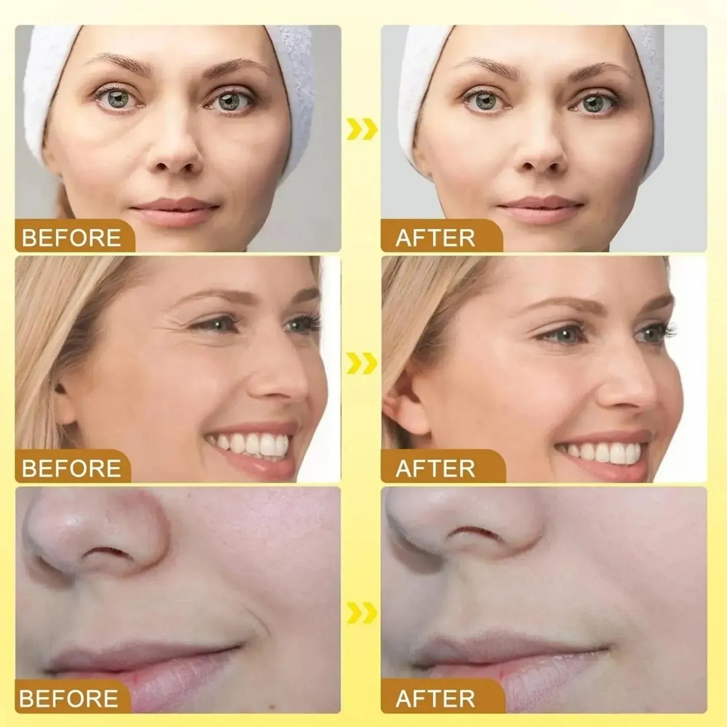 Botox BeeVenom Anti Wrinkle Cream
